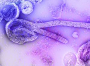 Ebola na África: 10 países em alerta máximo após surto explosivo