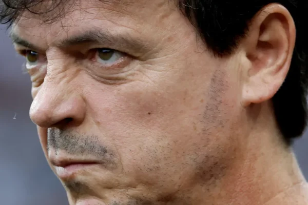 Diniz confia em virada no Corinthians com treinos e retorno de lesionados